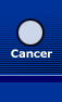 breast cancer