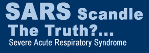 sars